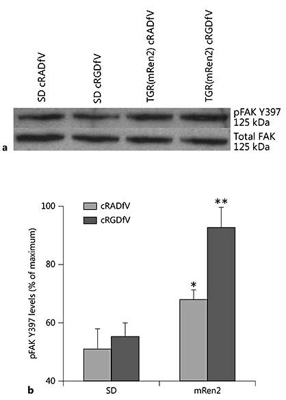Fig. 1. FAK Y397 phosphorylation in the resistance arteries of TGR(mRen2)27 rats treated with cRGDfV. a Representative Western blot of pFAK Y397 and total FAK (125 kDa) using 25 μg of protein from resistance artery extracts. b Levels of pFAK Y397 analyzed by densitometric scans and corrected for total FAK (n ≥ 4, * p < 0.05, ** p < 0.01).