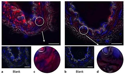 Fig. 2. Basal levels of pFAK Y397 immunofluorescence in resistance mesenteric arteries. a, c TGR(mRen2)27 rat mesenteric artery and the prominent localization of pFAK Y397 to VSMCs. b, d pFAK Y397 localization in SD rat resistance arteries is loosely distributed throughout the cells in contrast with TGR(mRen2)27 rat arteries. ×1,000. Scale bar: 25 µm.