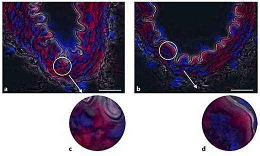 Fig. 3. Total FAK (nonphosphorylated) immunofluorescence in resistance arteries. a, c The localization of total FAK throughout the VSMCs of TGR(mRen2)27 rat mesenteric artery. b, d Similarly, total FAK is present throughout the VSMCs of SD rat mesenteric arteries. ×1,000. Scale bar: 25 μm.