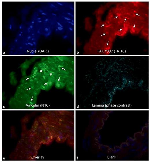 Fig. 4. Localization of FAK Y397 at FA sites in SD rat resistance arteries. a DAPI staining for nuclei of within the resistance artery. FAK Y397 (b), vinculin staining (c) and phase-contrast images of the elastic lamina (d) demonstrate colocalization of FAK Y397 to FA sites within the medial layer of the artery (e). f A blank control.
