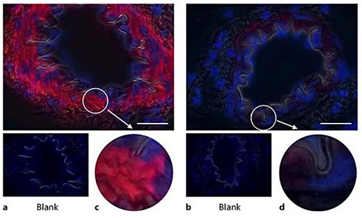 Fig. 5. pFAK Y397 immunofluorescence of rat mesenteric arteries following α5 antagonism by cRGDfV treatment (10 mg/kg, intraperitoneal injection twice daily for 5 days). a, c pFAK Y397 staining is increased and present throughout the VSMC medial layer of TGR(mRen2)27 rat resistance arteries. b, d In contrast, cRGDfV treatment has no effect on pFAK Y397 levels in SD rat mesenteric arteries. ×1,000. Scale bar: 25 μm.