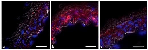 Fig. 6. Immunofluorescence localization of phosphorylated FAK Y397 after ex vivo pressurization (60 and 120 mm Hg) of cremaster arteries. a, b PP3 coincubation has no effect on pressure-induced myogenic constriction or phosphorylation levels of FAK Y397. a Arteries at 60 mm Hg only present minimal phosphorylation of FAK Y397. b Arteries pressurized at 120 mm Hg exhibit prominent phosphorylation levels of FAK Y397. c Phosphorylation of FAK Y397 was abrogated when arteries were incubated with 1 µM PP2. Scale bar: 25 µm.