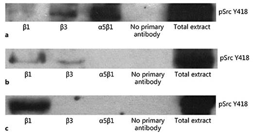 Fig. 8. Integrin immunoprecipitation: coprecipitation of pSrc Y418. a pFAK pSrc Y418 is coprecipitated with β3 and α5β1 integrins in SD rat arteries. b In TGR(mRen2)27 rats, pSrc Y418 is coprecipitated with β1 and β3 integrins. c In contrast, cRGDfV treatment results in coprecipitation of pSrc Y418 with β1 integrins only. Immunoprecipitations shown are representative of at least 3 experiments.