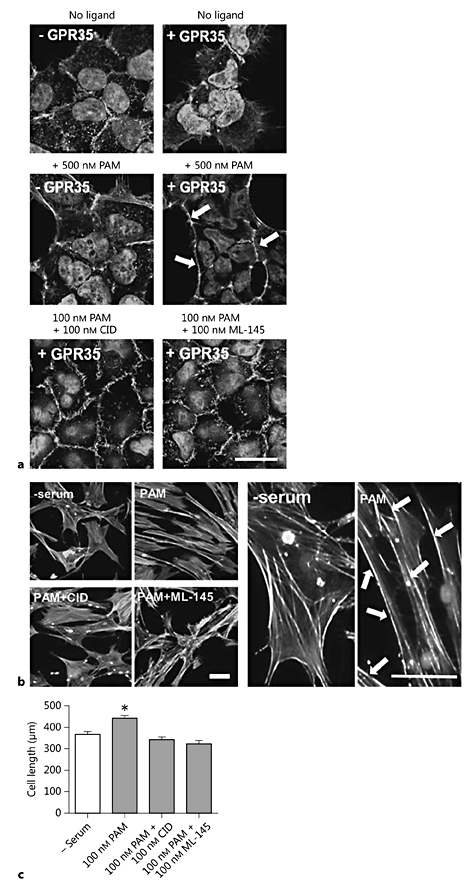 Fig. 3. Pamoic acid induces changes in cell morphology which are blocked by the hGPR35-selective antagonists CID-2745687 and ML-145. a Images of doxycycline-inducible Flp-In T-REx 293 cells stably expressing FLAG-hGPR35-eYFP ± 100 ng/ml doxycycline (±GPR35) stimulated with 500 nM pamoic acid (PAM) 24 h later, either alone or in the presence of 100 nM CID-2745687 (CID) or 100 nM ML-145 for 45 min (n = 4 per condition). Cells were stained for F-actin using TRITC actin phalloidin and imaged via spinning-disk illumination VivaTome™ microscopy. Scale bar = 20 µm. b Representative images of quiescent HSV SMCs fixed and stained for F-actin following stimulation with 100 nM of PAM ± antagonists CID or ML-145 for 45 min (n = 3). Scale bars = 50 µm. Arrows highlight changes in actin filament organization following pamoic acid stimulation. c Quantification of HSV SMC length (µm) in the presence of 100 nM PAM ± antagonists CID and ML-145 (3 experiments; 40-60 cells measured/condition/experiment). Data are shown as means ± SEM. * p < 0.001 versus serum control, analyzed via 1-way ANOVA with Dunnett's test for multiple comparisons.