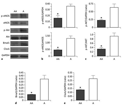 Fig. 2. Reduced p-AKT, p-eNOS BMAL1, and CLOCK in the aortic arch relative to the aorta. The aorta or aortic arch was isolated from mice at 10 a.m., and protein lysates were made. Fifty micrograms of protein were run on SDS-PAGE electrophoretic gel and transferred to nitrocellulose membrane and probed with antibodies. a Representative Western blot of p-eNOS total eNOS, p-AKT, total AKT, BMAL1, CLOCK, and GAPDH. Densitometric quantification p-eNOS and total eNOS (b), p-AKT and total AKT (c), BMAL1 (d), and CLOCK (e). n = 4. * p < 0.05. AA, aortic arch; A, aorta.