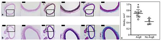 Fig. 6. Histology and quantitative analysis of aortas from rats infused and not infused with AngII. H&E- (left), VVG- (middle), and MTC- (right) stained sections of suprarenal aortas from a rat in Cohort 3 (a) and a rat not infused with AngII (b). The boxes mark a magnified view that is shown on the right of each section. Scale bars, 500 μm (×4 magnification) and 200 μm (×10 magnification). The mean cross-sectional area of the media (c) of the suprarenal aortas of AngII-infused rats (n = 8; age: 6.7 ± 2.8 months; mass: 368 ± 53.5 g) was 1.6-fold greater (* p = 0.0036) than for rats not infused with AngII (n = 4; age: 4.3 ± 1.9 months; mass: 378 ± 83.2 g).