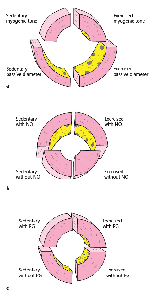 Fig. 4. Exercise training-induced remodeling of rat intramural coronary arterioles: a schematic representation. Wall sections of exercised and sedentary male rat coronary arteriole segments in spontaneous myogenic tone without (a) and with (b, c) inhibitors. a Coronary arterioles in control myogenic tone at 120 mm Hg intraluminal pressure and with the passive diameter. b The effect of the NO inhibitor Nω-nitro-L-arginine (in the presence of prostanoids) reveals an increased (NO-mediated) dilation effect in myogenic tone at 30 mm Hg intraluminal pressure in the coronary arterioles of exercised rats. c The effect of the cyclo-oxygenase inhibitor INDO (in the presence of NO) reveals the presence of endogenous constrictor prostanoids at 120 mm Hg intraluminal pressure in the coronary arterioles of sedentary animals, which is missing in the exercised group.