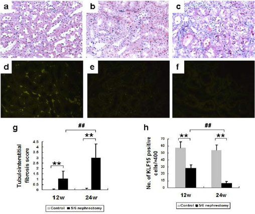 Fig. 1. Renal pathology and KLF15 expression. Representative of Masson's trichrome staining (magnification×400) in renal sections from control (a) and 5/6 nephrectomized rats at 12 weeks (b) or 24 weeks (c). Interstitial fibrosis score (g) revealed that there were more tubulointerstitial lesions and fibrosis in 5/6 nephrectomized rats, especially at 24 weeks. Representative of immunofluorescence staining of KLF15 (magnification×400) in renal sections from control (d) and 5/6 nephrectomized rats at 12 weeks (e) or 24 weeks (f). There were abundant KLF15-positive cells in the interstitium of the normal kidney, and the number decreased significantly in the remnant kidney 12 weeks after 5/6 nephrectomy, and few positive cells were detectable in 5/6 nephrectomized rats at 24 weeks (h). Data are mean ± SD, **P<0.01 versus control, ##P<0.01 5/6 nephrectomized rats at 12 weeks versus 24weeks. n=6/group.