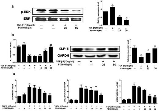 Fig. 4. KLF15 expression is regulated by the TGF-β1-ERK MAPK pathway in NRK-49F cells. (a) Western blot analysis showed that pretreatment with ERK1/2 MAPK inhibitor PD98059 attenuated the TGF-β1-induced upregulation of phosphorylated ERK in NRK-49F cells. (b) Specific ERK1/2 MAPK inhibitor PD98059 abolished the TGF-β1-induced downregulation of KLF15 mRNA and protein levels in NRK-49F cells in a dose-dependent manner. (c) Inhibition of ERK1/2 MAPK prevented TGF-β1-induced extracellular matrix accumulation (including fibronectin and type III collagen) and downregulated CTGF expression in NRK-49F cells. Data are mean ± SD, **P<0.01 versus control group, #P<0.05, ##P<0.01 versus TGF-β1 treated group. n≥3, each experiment was performed in triplicate.