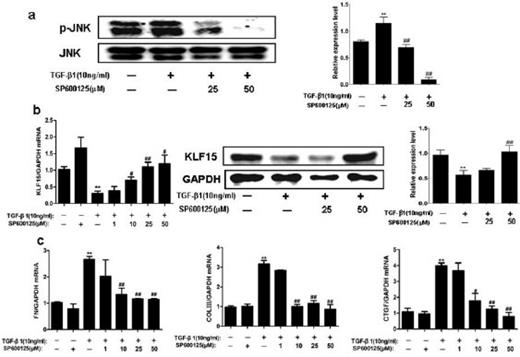 Fig. 5. KLF15 expression is regulated by the TGF-β1-JNK MAPK pathway in NRK-49F cells. (a) Western blot analysis showed that pretreatment with JNK1/2 MAPK inhibitor SP600125 attenuated the TGF-β1-induced upregulation of phosphorylated JNK in NRK-49F cells. (b) Specific JNK1/2 MAPK inhibitor SP600125 abolished the TGF-β1-induced downregulation of KLF15 mRNA and protein levels in NRK-49F cells in a dose-dependent manner. (c) Inhibition of JNK1/2 MAPK prevented TGF-β1-induced extracellular matrix accumulation (including fibronectin and type III collagen) and downregulated CTGF expression in NRK-49F cells. Data are mean ± SD, **P<0.01 versus control group, #P<0.05, ##P<0.01 versus TGF-β1 treated group. n≥3, each experiment was performed in triplicate.