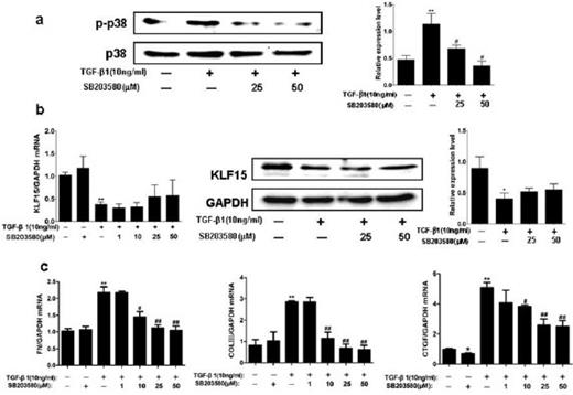 Fig. 6. Blockage of p38 has no effect on the TGF-β1-reduced expression of KLF15 in NRK-49F cells. (a) Western blot analysis showed that pretreatment with p38 MAPK inhibitor SB203580 attenuated the TGF-β1-induced upregulation of phosphorylated JNK in NRK-49F cells. (b) Specific p38 MAPK inhibitor SB203580 did not abolish the TGF-β1-induced downregulation of KLF15 mRNA and protein levels in NRK-49F cells. (c) Inhibition of p38 MAPK prevented TGF-β1-induced extracellular matrix accumulation (including fibronectin and type III collagen) and downregulated CTGF expression in NRK-49F cells. Data are mean ± SD, *P<0.05, **P<0.01 versus control group, #P<0.05, ##P<0.01 versus TGF-β1 treated group. n≥3, each experiment was performed in triplicate.