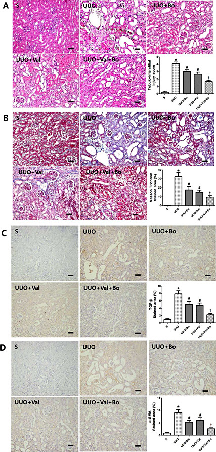 Fig. 3. Representative kidney tissue sections with H&E staining (A), Masson's trichrome staining (B), and immunostaining for TGF-β (C), and α-SMA (D). (A) Bosentan and valsartan treatment significantly reduced renal injury scores in UUO kidneys. Co-treatment with bosentan and valsartan reduced renal injury scores significantly compared to single treatments (B) The blue-stained fibrotic area of the kidney was greater in vehicle-treated UUO mice than in sham mice, and co-treatment with bosentan and valsartan reduced the fibrotic area significantly in UUO kidneys compared to single treatments. The TGF-β-positive area (dark brown, C) and α-SMA-positive area (dark brown, D) of the kidney were greater in vehicle-treated UUO mice than in sham mice. Bosentan and valsartan treatment significantly reduced the α-SMA and TGF-β-positive areas in UUO kidneys, as did co-treatment, compared to single treatments. * P < 0.05, vs. Sham, # P < 0.05, vs. UUO, † P < 0.05, vs. single treatment in UUO, original magnification ×200, scale bar = 100 μm.