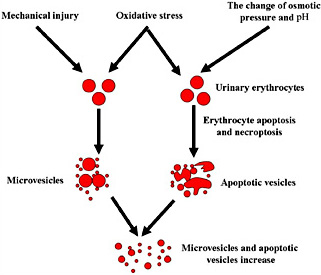 Fig. 1. The generation mechanism of erythrocyte-derived vesicles (microvesicles and apoptotic vesicles) in urine. When urinary red blood cells are compressed while exiting out of an impaired nephron, under the condition of mechanical injury and then hemolysis, the numbers of erythrocyte-derived microvesicles in urine will increase. More importantly, dissolution of urinary red blood cells can also stimulate oxidative stress. Oxidative stress cannot only make red blood cells release more microvesicles but also make red blood cells undergo apoptosis and necroptosis, and secrete apoptotic vesicles. In addition, the change in osmotic pressure and pH can also lead to erythrocyte apoptosis.