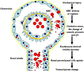 Fig. 2. The process of erythrocyte-derived vesicles (microvesicles and apoptotic vesicles) interfering with renal parenchymal cells. In the presence of IgAN, peripheral blood erythrocytes will be subjected to mechanical injury by extruding defective glomerular filtration membranes, or subjected to damage from the change in osmotic pressure and pH, and high oxidative stress in the renal tubules. Therefore, erythrocytes will occur in cell shrinkage, morphological changes, or even erythrocyte apoptosis, and erythrocyte-derived vesicles increase. After absorbing miRNA-rich vesicles, the transcriptome of renal parenchymal cells will change.