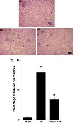 Fig. 4. Effect of tempol on the morphologic changes of kidney tissues. PAS staining kidney sections were taken from sham group (A), I/R group (B) and I/R pretreated with tempol (50 mg/kg, C) and kidney injury was quantitatively measured by percentage of tubular necrosis in the cortex (D). Data were expressed as mean ± SEM, n=3, * p< 0.05 vs sham group, # p < 0.05 vs I/R group.
