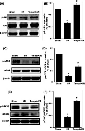 Fig. 5. Effect of tempol on the expression of Akt/mTOR and GSK3β pathways in I/R injury. Data were expressed as mean ± SEM, n=5, * p < 0.05 vs sham group; # p < 0.05 vs I/R group.