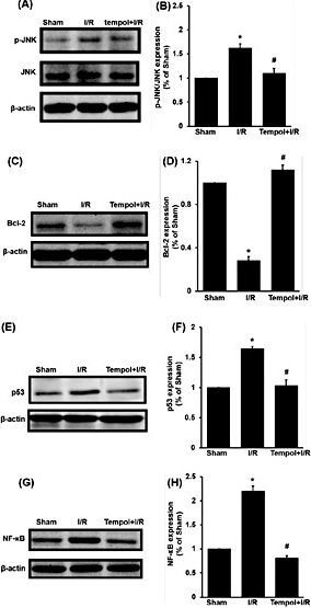 Fig. 6. Effect of tempol on the expression of apoptosis and inflammation pathways in renal I/R injury. Data were expressed as mean ± SEM, n=5, * p < 0.05 vs sham group; # p < 0.05 vs I/R group.