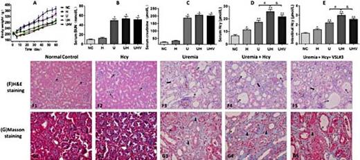 Fig. 1. Body weight changes, renal function, serum and intestinal Hcy, and pathological changes of renal structure of each group. [A] The average daily body weight of rats in each group during the experiment. The body weight of rats began to decrease after initiating treatment with adenine and continued to increase slowly, which was accompanied with a yellow haired and dispirited appearance in groups U and UH throughout the experiment. The final body weight (mean ± SD) of the rats in each group was significantly different: the final body weight of rats in group H (338 ± 12.49 g), group U (285 ± 15.66 g), group UH (270 ± 10.14 g), and group UHV (293 ± 10.08 g) was significantly lower than that of group NC (370 ± 11.87 g) (p< 0.01); the body weight of group H was lower than that of group NC (p< 0.01), but was much higher compared with groups U, UH, and UHV (p< 0.01); the body weight of group UH was smaller than that of group U, but not significantly so (p > 0.05); the body weight of group UHV was significantly less than that of groups NC and H, but was significantly higher than that of group UH (p< 0.01). [B] [C] BUN and Scr. The BUN and Scr levels of group H were slightly elevated (p > 0.05) compared with group NC; their levels in groups U, UH and UHV were significantly increased compared with group NC (p< 0.001); the BUN and Scr levels of group UH were slightly higher than those of group U (p > 0.05); there was no significant difference in their levels between groups UHV and UH (p > 0.05). [D] [E] Serum and intestinal Hcy. The concentrations of serum and intestinal Hcy were significantly increased in groups H, U, and UH compared with group NC. The levels of Hcy in serum and intestinal tissue were decreased significantly in group UHV compared with group UH. [F] [G] Representative graphs of renal histopathological structural changes. (H&E and Masson’s trichrome staining, magnification ×200, scale bar 100 μm.) Glomerular integrity and the renal interstitium were basically complete and generally normal in groups NC and H. Renal pathology changed drastically in groups U, UH, and UHV with glomerular mesangial proliferation, extensive expansion of renal tubules and even partial atrophy, interstitial collagen fiber hyperplasia, and a large number of infiltrating inflammatory cells. Thin arrows indicate the glomeruli; thick arrows indicate the renal interstitium with infiltrating inflammatory cells; small triangles represent the increased collagen fibers in the interstitial tissue of the kidney. Data were analyzed by the one-way ANOVA with a post hoc Tukey’s or Dunn’s test. *p< 0.05, vs. group NC; #p < 0.05, group UH vs. group U; &p< 0.05, group UHV vs. group UH.