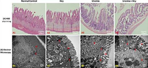 Fig. 2. Representative photomicrographs of H&E staining and transmission electron microscopy detection of the ileum. [A] H&E staining of ileal pathological changes (magnification ×200, scale bar 100 μm). The black thin arrows indicate intestinal villi. Group NC exhibited approximately normal intestinal structure with tall and tightly lined villi. There was no stratification or inflammatory cell infiltration of the submucosa. The intestinal villi in group H showed mild looseness and slight submucosal stratification. The intestinal villi in group U were ruptured and loosely arranged, and the mucosal and submucosal membranes were separated and extended to both sides of the intestinal villi with infiltrating inflammatory cells. In group UH, the damage to the villi and submucosal tissue was more serious, with an arrangement of sparse, ruptured, and bald villi, and the stratification of the submucosal tissue was more severe. [B] Transmission electron microscopy photomicrographs of the ileal mucosa of each group. Thin arrows indicate tight junctions; short thick arrows indicate intestinal villi; triangles indicate inflammatory edema and collagen fibers (magnification ×30,000, scale bar 1 μm). Group NC exhibited a tight arrangement of intestinal microvilli and clear intercellular tight junction structure. Group H showed slightly sparse microvilli and basically normal tight junction structure. Group U exhibited sparse and irregular microvilli, lightly stained tight junctions between epithelial cells, and obvious edema with visible collagen fibers in the intestinal mucosa. Group UH exhibited serious edema and the deposition of many collagen fibers in the mucosa, with decreased or even fractured microvilli and worse organization of the epithelial layer. The tight junction structure was fuzzy and shallow and its continuity was destroyed.