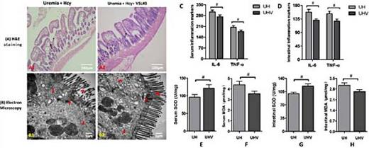 Fig. 5. Representative intestinal photomicrographs of H&E staining and transmission electron microscopy analysis of groups UH and UHV. [A] H&E staining photomicrographs. In group UHV, the damage to the intestinal mucosa showed an obvious improvement. Submucosal stratification was discontinuous and the broken and disrupted villi were reduced compared with group UH. [B] Transmission electron microscopy photomicrographs. In group UHV, the destruction of the intestinal epithelium and mucous membranes was reduced considerably with better organization of the microvilli and decreased collagen deposition compared with group UH. [C] Serum interleukin (IL)-6 and TNF-α. [D] Intestinal IL-6 and TNF-α. [E] Serum SOD. [F] Serum MDA. [G] Intestinal SOD. [H] Intestinal MDA. Compared with group UH, the serum and intestinal tissue levels of IL-6, TNF-α, and MDA were decreased with an improvement of SOD to different degrees in group UHV. Student’s t-test was used to examine the differences in inflammatory and oxidative markers between groups UHV and UH. #p< 0.05, group UHV vs. group UH.
