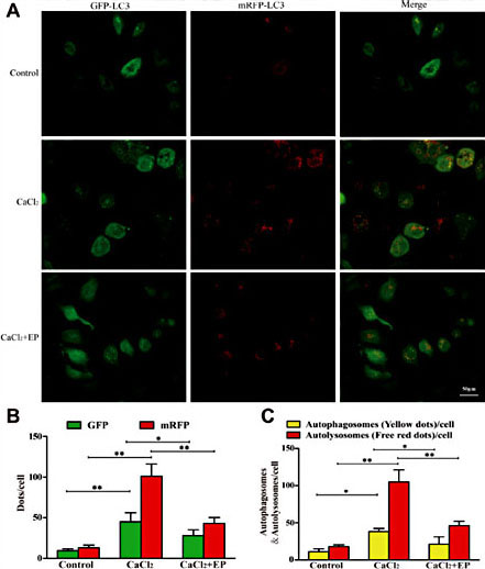 Fig. 4. Induction of autophagy in HK-2 cells that were transduced with the adenovirus AdmRFP-GFP-LC3 and incubated with CaCl2 (1.0 mg/ml, 12 h) with or without EP pretreatment (2.5 mM, 2 h). (A) In the merged image, the yellow dots indicate autophagosomes, and the red dots indicate autolysosomes. (B) Means ± SEM of the numbers of green and red dots per cell. (C) Means ± SEM of the numbers of autophagosomes and autolysosomes per cell. Data shown are from at least five independent experiments. *,P< 0.05. **,P< 0.01.