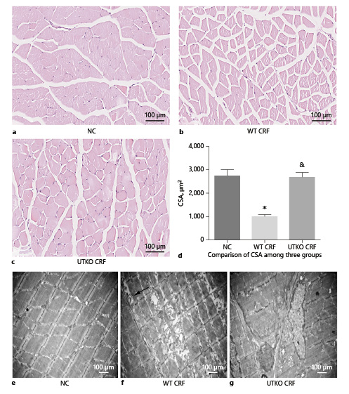 Fig. 2. Comparisons of muscle CSA and skeletal muscle ultrastructure among 3 groups by HE stain and electronic microscope examination. a NC: Sham operation as NC. b WT CRF: Wild-type mice with 5/6 nephrectomy. c UTKO CRF: UTKO with 5/6 nephrectomy mice. d Comparison of CSA among 3 groups. * p < 0.05 vs. NC, & p < 0.05 vs. WT CRF. CSA: cross sectional area. Scale bar = 100 μm in (a – c). e NC by electronic microscope examination (EM). f WT CRF by EM. g UTKO CRF by EM. Arrows indicate autophagosomes in (f). Scale bar = 1 μm in (e – g). CSA, cross sectional area; NC, normal control; WT CRF, wild-type chronic renal failure; UTKO CRF, UII receptor gene knockout chronic renal failure group.