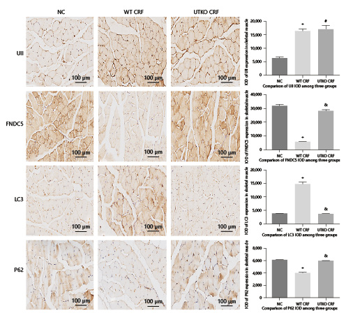 Fig. 3. Expression of UII, FNDC5, LC3 and p62 in 3 groups detected by immunochemistry. NC: sham operation as NC. WT CRF: wild-type mice with 5/6 nephrectomy. UTKO CRF: UTKO with 5/6 nephrectomy mice (* p < 0.05 vs. NC, # p < 0.05 vs. NC, & p < 0.05 vs. WT CRF). Scale bar = 100 μm. FNDC5, fibronectin type III domain containing 5; IOD, integral optical density; UII, urotensin II; NC, normal control; WT CRF, wild-type chronic renal failure; UTKO CRF, UII receptor gene knockout chronic renal failure group.