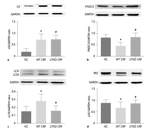 Fig. 4. Comparison of UII, FNDC5, LC3II and p62 expression among 3 groups by western blot. NC: sham operation as NC. WT CRF: wild-type mice with 5/6 nephrectomy. UTKO CRF: UTKO with 5/6 nephrectomy mice. * p < 0.05 vs. NC, # p < 0.05 vs. NC, & p < 0.05 vs. WT CRF. FNDC5, fibronectin type III domain containing 5; UII, urotensin II; NC, normal control; WT CRF, wild-type chronic renal failure; UTKO CRF, UII receptor gene knockout chronic renal failure group.