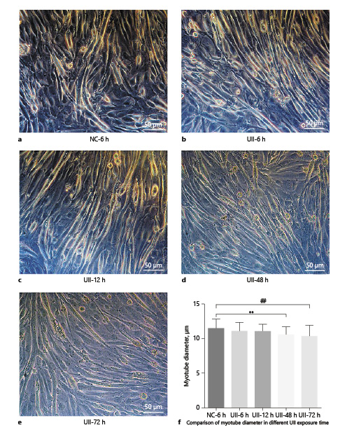 Fig. 5. The effect of UII with different exposed time on mouse myotube diameters. a NC: PBS serving as a substitution for UII. b – e 10–7 M UII exposure time 6, 12, 48, 72 h respectively. f Comparison of myotube diameter in different UII exposure time (** p = 0.005 vs. NC, ## p = 0.001 vs. NC). Scale bar = 50 μm. UII, urotensin II; NC, normal control.
