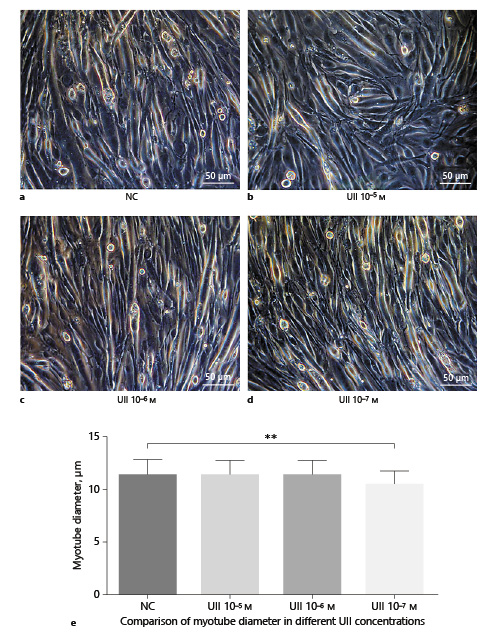 Fig. 6. UII with different exposed concentrations effect on mouse myotube diameters. a NC: PBS serving as a substitution for UII. b – d UII concentration 10–5, 10–6, 10–7 M respectively exposed 48 h. e Comparison of myotube diameter in different UII concentration (** p = 0.001 vs. NC). Scale bar = 50 μm. Exposure time = 48 h. UII, urotensin II; NC, normal control.