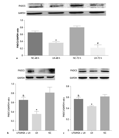 Fig. 8. UII exposure and blocking UII receptor action effect FNDC5 expression in C2C12 cells. a UII exposure group for 48 and 72 h (* p < 0.05 vs. NC-48 h, # p < 0.05 vs. NC-72 h). b, c FNDC5 expression among blocking UII receptor action (UT siRNA ) combined with UII, UII, and NC groups (& p = 0.006 vs. UII exposure alone, * p = 0.001 vs. NC for 48 h in b; & p = 0.004 vs. UII exposure alone, * p = 0.001 vs. NC for 72 h in c). NC: PBS serving as a substitution for UII. UII concentration 10–7 M. UII, urotensin II; NC, normal control; FNDC5, fibronectin type III domain containing 5.
