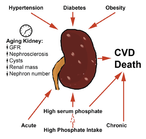 Fig. 1. Phosphate and kidney aging. Kidney aging implies lower GFR, renal mass and nephron number, and higher appearance of cysts and nephrosclerosis. High serum phosphate levels are associated with renal dysfunction accelerating aging and with cardiovascular disease risk and death. Although the influence of phosphate intake on serum phosphate levels is unclear, chronic high phosphate consumption increases mortality and cardiovascular disease risk. Acute high phosphate intake leads to acute kidney injury and ultimately to CKD. Hypertension, diabetes, and obesity are known risk factors of developing CKD. GFR, glomerular filtration rate.