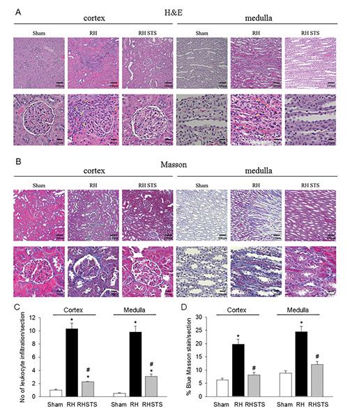  Histologic graphs from H&E stain (A) and Masson stain (B) were displayed in sham, RVHT, and STS-treated RVHT (RVHT STS) rats. A The increased leukocyte infiltration (yellow arrows) is indicated in the cortex and medulla of the RVHT kidney. B Increased Masson stain by blue color is indicated in the cortex and medulla of the RVHT kidney. The mean data of the number of leukocyte infiltration and % of blue Masson stain for each section are indicated in C, D, respectively. Data are expressed as mean ± SEM (n = 6). *p < 0.05 versus sham. #p < 0.05 versus RVHT. STS, sodium thiosulfate; RVHT, renovascular hypertension.