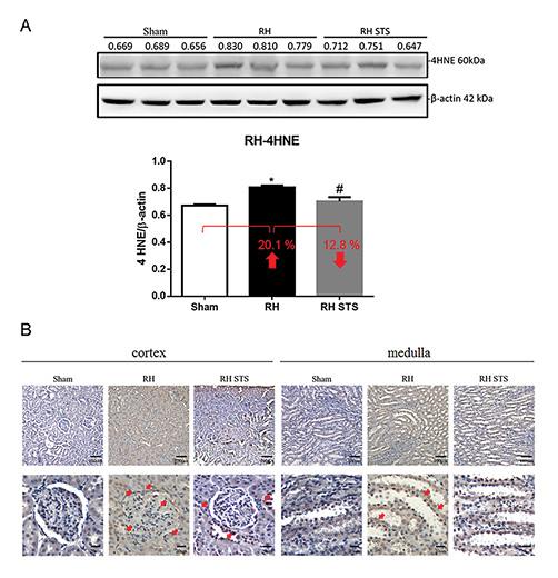 A Western blot of 4-HNE expression in RVHT-induced kidney injury. B Immunohistochemistry of 4-HNE is indicated in the cortex and medulla of the sham, RVHT, and RVHT STS kidneys. Data are expressed as mean ± SEM (n = 3). *p < 0.05 versus sham. #p < 0.05 versus RVHT. STS, sodium thiosulfate; RVHT, renovascular hypertension.