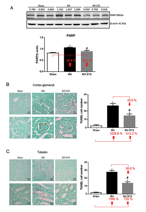  Western blot of renal PARP expression in RVHT-induced kidney injury (A) and TUNEL immunohistochemistry of renal cortex-glomeruli (B) and tubules (C) for TUNEL-positive cells indicated with red arrows counting in RVHT-induced kidney injury. Data are expressed as mean ± SEM (n = 3). *p < 0.05 versus sham. #p < 0.05 versus RVHT. RVHT, renovascular hypertension; PARP, poly(ADP-ribose) polymerase; STS, sodium thiosulfate.