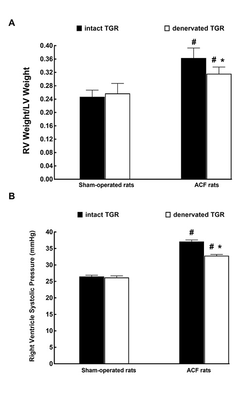 Fig. 7. The ratio of RV to LV weight (A) and RV systolic pressure (B) in intact, that is, nondenervated (solid bars), and denervated (open bars) TGR that were either with ACF (right-hand side) or sham-operated (left). Presented results were obtained in the fourth series of experiments. *p < 0.05 versus intact TGR. #p < 0.05 versus sham-operated TGR. All the values shown are means ± SEM. LV, left ventricle; RV, right ventricle; TGR, transgenic rats; ACF, aortocaval fistula.
