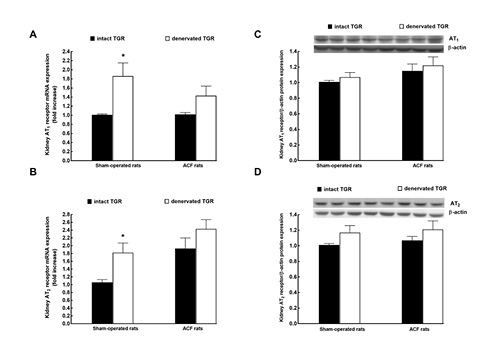 Fig. 8. Kidney angiotensin II receptor type 1 (AT1) mRNA (A) and protein (C) expression and kidney angiotensin II type 2 receptor (AT2) mRNA (B) and protein (D) expression in intact, that is, nondenervated (solid bars), and denervated (open bars) TGR that were either with ACF (right-hand side) or sham-operated (left). Representative blots are shown above panels C and D. *p < 0.05 versus intact TGR. All the values shown are means ± SEM. mRNA, messenger ribonucleic acid; TGR, transgenic rats; ACF, aortocaval fistula.