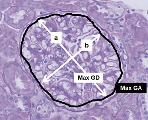 Fig. 1. Representative microphotographs of a glomerulus for the measurement of Max GD and Max GA. Max GD; maximal glomerular diameter; Max GA, maximal glomerular area.
