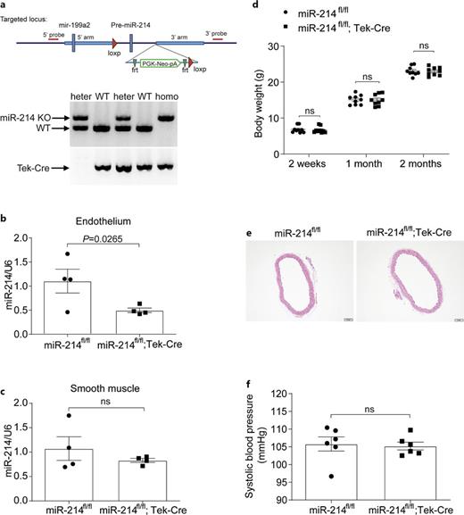 Generation and characterization of EC-specific miR-214-deficient mice. a Strategy for the conditional targeting of miR-214. The targeted allele and loxP loci were shown. Genotypes of heterozygous (heter) and homozygous (homo) knockout mice were detected with PCR. b, c qRT-PCR detected the specific deletion of miR-214 in aortic endothelium and smooth muscle part (n = 4). d Body weight of endothelial miR-214 cKO mice and their littermate WT controls from 2 weeks to 2 months old (n = 9). e Aorta morphology was analyzed using hematoxylin-eosin (HE) staining in endothelial miR-214 cKO mice and littermate WT controls at 3 months old (n = 4). f SBP of endothelial miR-214 cKO mice and littermate controls was detected by the tail-cuff method (n = 6). No difference of the baseline systolic blood pressure was found between genotypes. Data were expressed as means ± SEM. p < 0.05 was considered statistically significant.