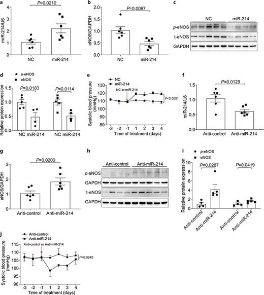 miR-214 regulated vascular eNOS in vivo. a miR-214 expression in aortas of wild-type mice after injection of miR-214 agomir. b Effect of miR-214 agomir on the mRNA expression of eNOS in mouse aortas (n = 6). c Effect of miR-214 agomir on the expressions of eNOS/p-eNOS. d Quantitative analysis of eNOS/p-eNOS western blots (n = 4–5). e SBP was detected by the tail-cuff method after the mice were given an intraperitoneal injection of miR-214 agonists (n = 5). f The effect of miR-214 antagomir on the expression of miR-214 in mouse aortas analyzed by qRT-PCR. g miR-214 antagomir effect on the mRNA level of eNOS in mouse aortas (n = 6). h Western blotting analysis of eNOS/p-eNOS protein expressions after miR-214 antagomir treatment. i Quantification of the Western blots of eNOS/p-eNOS (n = 4–5). j SBP was detected by the tail-cuff method after the mice were given an intraperitoneal injection of miR-214 inhibitors (n = 5). C57BL/6 mice were injected with miR-214 inhibitors and agonists, respectively (10 mg/kg, i.p.), and then aorta tissues were collected after 4 days of treatments. Values were presented as means ± SEM. Difference between groups was considered statistically significant when p < 0.05.