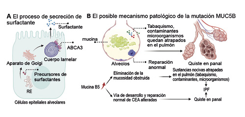  El proceso de secreción de surfactante y el mecanismo patológico potencial de la mutación MUC5B. (a) Los precursores del surfactante se sintetizan en el retículo endoplásmico, seguido por modificaciones en el Golgi, y finalmente se secretan en la periferia por exocitosis citosólica del cuerpo lamelar. (b) La mutación de MUC5B puede promover la retención de sustancias nocivas en el pulmón e interferir en la reparación normal de las CEA.