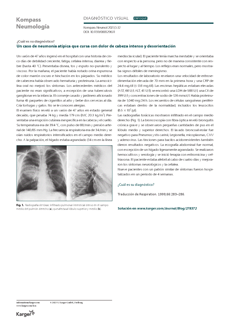 First page of Un caso de neumonía atípica que cursa con dolor de cabeza intenso y desorientación