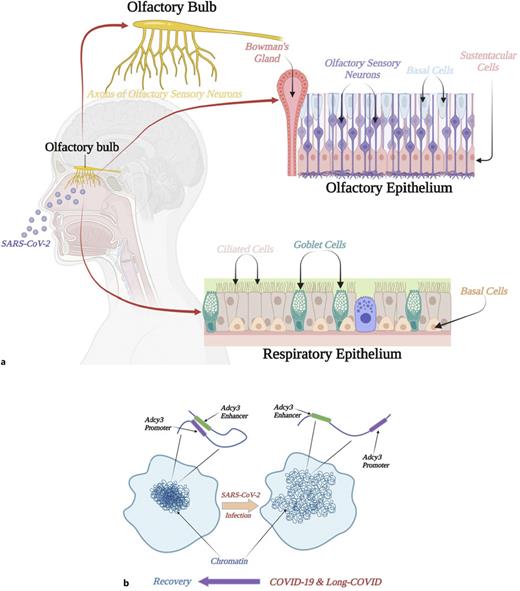 Anatomy and pathophysiology of the non-cell-autonomous SARS-CoV-2-related loss of smell (adapted from [76] and created with BioRender.com). a SARS-CoV-2 infects olfactory support cells known as sustentacular cells that surround OSNs in the OE where the initial step of odor detection takes place. Bowman gland cells, another type of support cells for OSNs, are also infected by SARS-CoV-2. Related to the loss of smell is the desquamation of the OE and especially the deciliation, and possibly the death of OSNs, as an indirect result of the massive infection of SUS cells by SARS-CoV-2. SARS-CoV-2 attacks the respiratory and olfactory mucosae, but the OB that would provide a route of entry to the CNS seems to be spared customarily. b SARS-CoV-2 infection of neighboring SUS cells results in chromatin rearrangement in the OSNs from the typical ‘“fried-egg”’-like nuclear conformation that ensures silencing via juxtaposition to heterochromatin, to disruption of long-range interactions between enhancers (green) and promoters (purple) and to the downregulation of odorant receptor-related genes, e.g., of Adcy3. This longer-lasting disruption in chromosomal regulation of gene expression may represent a form of “nuclear memory” that could prevent the restoration of odorant receptor transcription even after SARS-CoV-2 is cleared. It is unclear how such profound changes in the nuclear architecture in OSNs occur postinfection of cells which the virus does not typically infect.