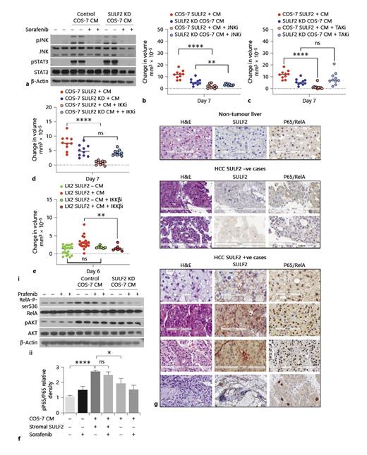 Fig. 6. Stromal SULF2-dependent Hep3B growth and sorafenib sensitivity were regulated by TAK1/IKKβ/NF-κB RelA-P-ser536, with nuclear p65 associated with stromal SULF2. a Western blotting of Hep3B whole cell lysates, showed that activation of JNK/pJNK and STAT3/pSTAT3 pathways in Hep3B cells was driven by COS-7 CM independently of SULF2 and was sensitive to sorafenib treatment. b JNK inhibition limited Hep3B spheroid growth in both SULF2-dependent and independent fashion. In contrast, TAK1 (c) or IKKβ (d) inhibition limited SULF2-dependant Hep3B spheroid growth. e Similarly, Hep3B spheroid growth promoted by CM from SULF2-expressing LX-2 cells was suppressed by IKKβ inhibition. fi Activation of RelA-P-ser536 in Hep3B cells was dependent on control COS-7 CM and persistent in the presence of sorafenib, as was AKT activation. Quantification of RelA-P-ser536 (p-p65) relative to total p65 detected by Western blot is shown in fii, where data are mean ± SEM of 4 experiments. g IHC staining confirmed that SULF2 positivity in stromal cells associated with nuclear RelA-P-ser536 in adjacent tumour cells. Images are at ×20 magnification; scale bars represent 100–200 microns. Hep3B spheroid data are expressed as mean ± SEM of n= 10 experimental repeats. ns, not significant, *p= 0.05,**p&lt; 0.01; ***p&lt; 0.001, ****p&lt; 0.0001.