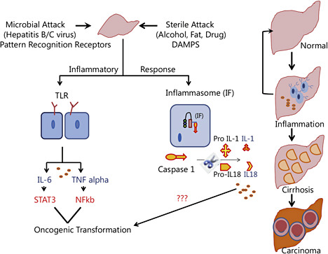 Fig. 3. Inflammation is a hallmark of injured liver. The inflammatory response, caused by viral (microbial attack) or nonviral etiologies (sterile attacks), leads to production of proinflammatory cytokines such as IL6, TNF-α, IL1 and IL18 through inflammasome-independent or -dependent pathways. The inflammasome component provides a platform for activation of caspase, which in turn cleaves Pro-IL1/IL18 to their active forms. Proinflammatory cytokines, through activation of transcription factors or by yet unknown mechanisms, make the hepatic milieu a fertile zone for cellular transformation. The accompanying pathological stages are shown in the right panel. DAMPS= damage-associated molecular patterns.