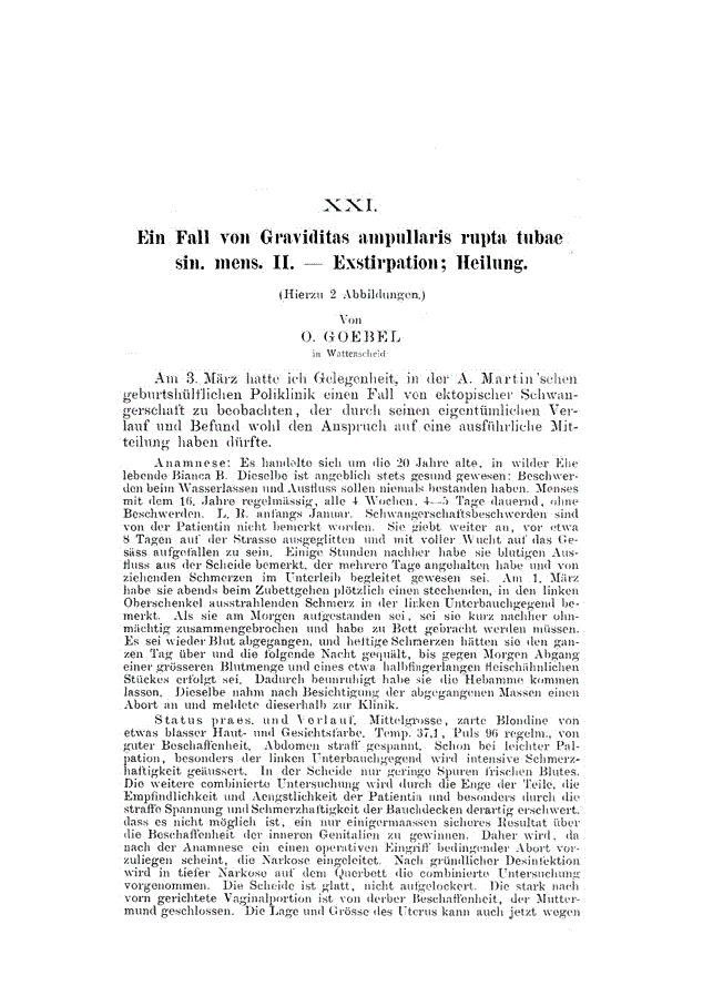 First page of XXI. Ein Fall von Graviditas ampullaris rupta tubae sin. mens. Exstirpation; II. Heilung<subtitle>(Hierzu 2 Abbildungen.)</subtitle>