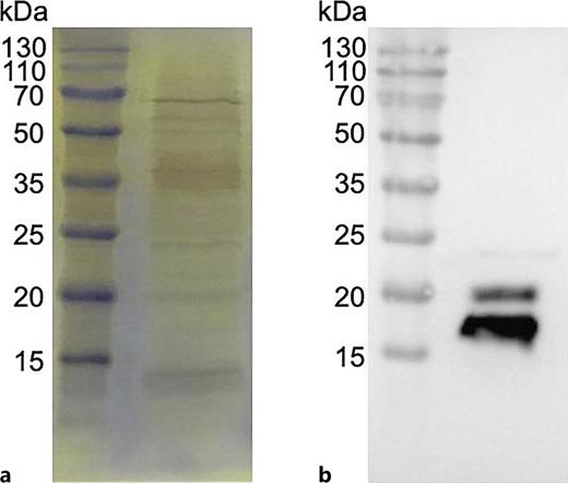 Detection of protein samples obtained by Co-IP using S-tag keratin monomers as bait in DHHJ total proteins. a SDS-PAGE silver staining. b Western blotting.