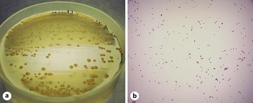 Macroscopic and microscopic examinations of the c4a strain. a The colony morphologies of the c4a strain on LB agar plate. b Gram-stained c4a cells observed under a phase-contrast microscope (×1,000).