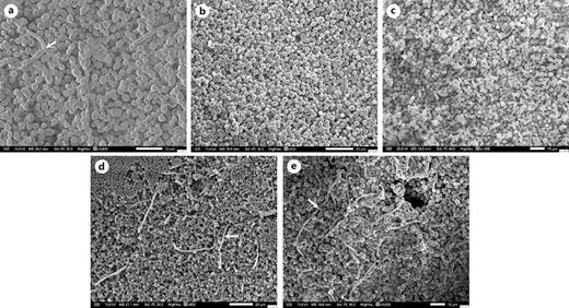Scanning electron microscopy images of Candida species growing in single and mixed cultures after 20 h of incubation in plates of 12 wells. C. albicans DCA53 (a), C. tropicalis DCT6 (b), C. parapsilosis DCP1 (c), C. albicans DCA53 + C. parapsilosis DCP1 (d), and C. albicans DCA53 + C. tropicalis DCT6 (e). Arrows indicate hyphae.