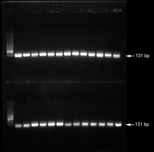 Representative image showing amplification products at 131 bp, suggestive for GAPDH housekeeping gene detection. First lane: molecular ladder 1 kbp.